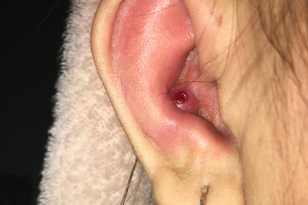 Xỏ Conch có đeo tai nghe được không