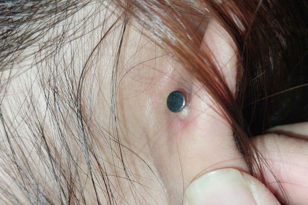 Xỏ Conch có đeo tai nghe được không