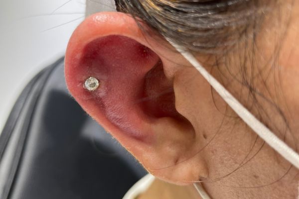 Xỏ Helix bao lâu lành?