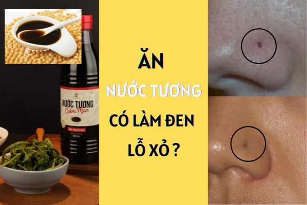 Xỏ khuyên ăn nước tương được không? Có bị đen lỗ xỏ khuyên?