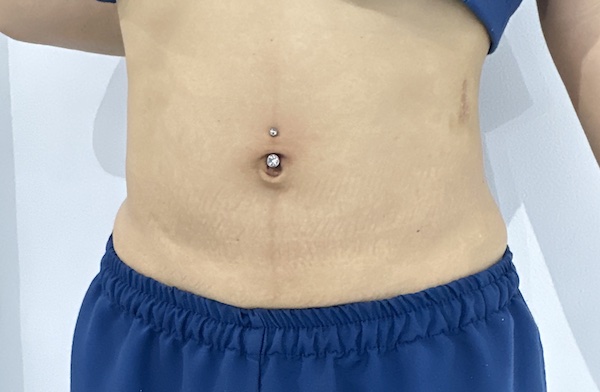 xỏ khuyên bụng tại thế giới xỏ khuyên tinybox