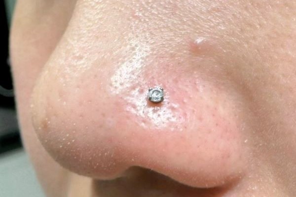 Ảnh xỏ khuyên cánh mũi đẹp