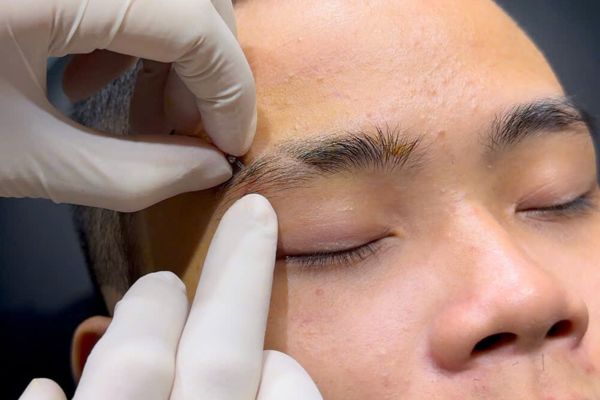 Xỏ khuyên chân mày có để lại sẹo không?