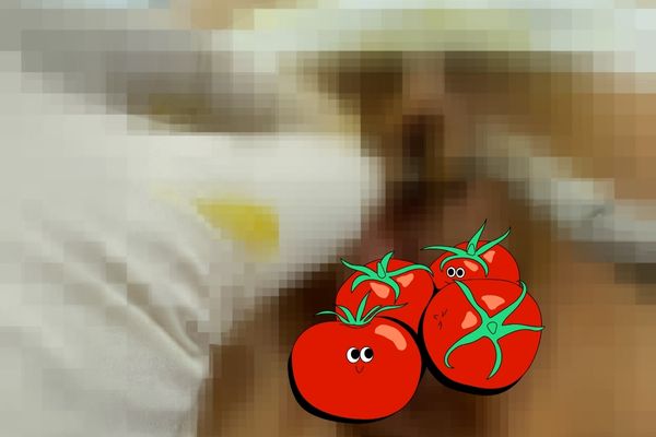 Xỏ khuyên chem chép - xỏ khuyên lồn