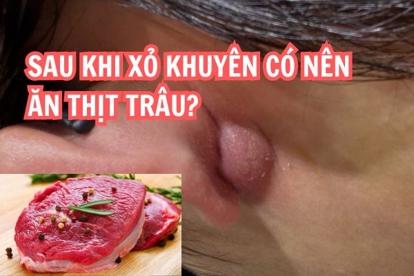 Xỏ khuyên có ăn thịt trâu được không?