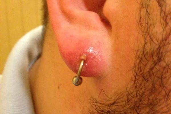 Xỏ khuyên có hại không?