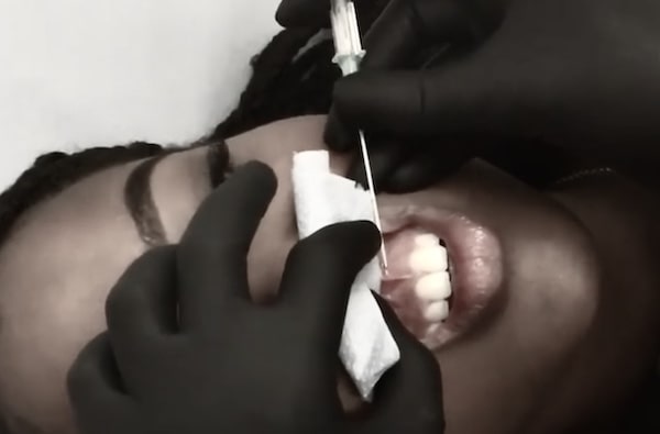 Xỏ khuyên dây chằng xỏ khuyên smiley