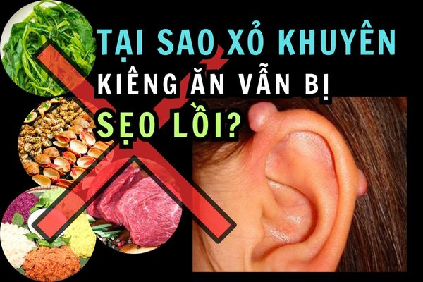 Xỏ khuyên kiêng ăn nhưng vẫn bị sẹo lồi?