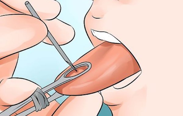 xỏ khuyên lưỡi có đau không