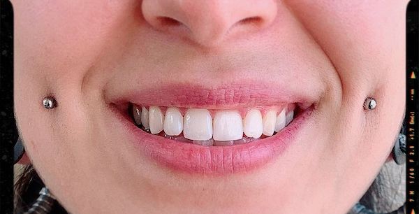 Xỏ khuyên má lúm