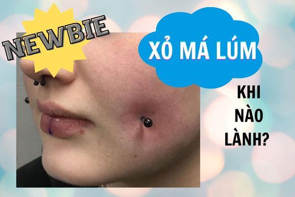 Xỏ khuyên má lúm bao lâu thì khỏi?