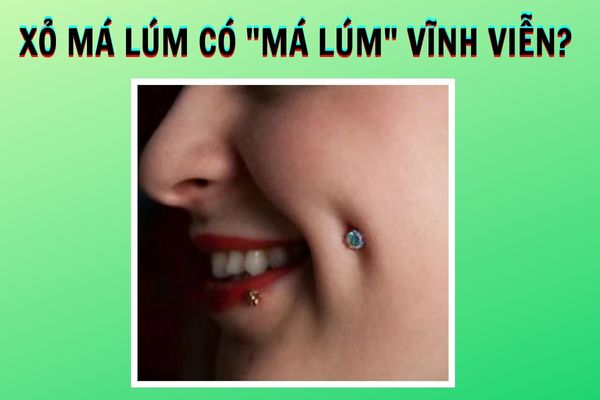 Xỏ khuyên má lúm