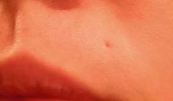 Xỏ khuyên môi có để lại sẹo không?