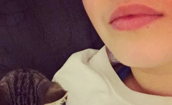 Xỏ khuyên môi có để lại sẹo không?