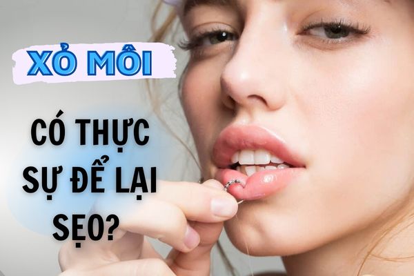 Xỏ khuyên môi có để lại sẹo không?