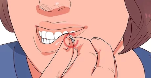 xỏ khuyên môi có tháo được không?