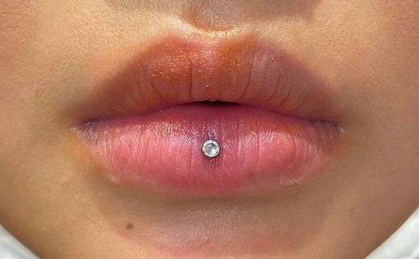 Xỏ khuyên môi đánh răng được không?