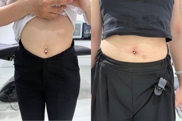 xỏ rốn chọn kiểu dáng và chất liệu phù hợp để xỏ khuyên mùa hè không bị viêm