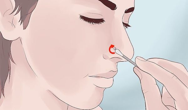 Cách chữa xỏ khuyên mũi bị lồi thịt