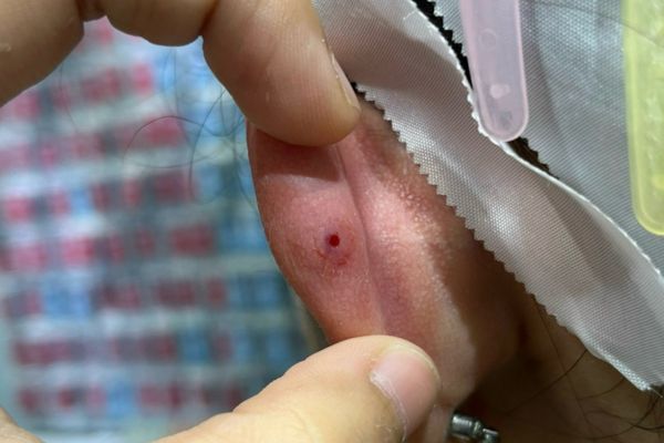 Xỏ khuyên nẹp bump luôn được không?