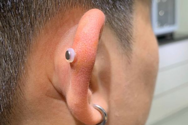 Xỏ khuyên nẹp bump luôn được không?