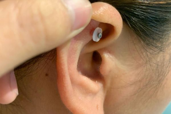 Xỏ khuyên nẹp bump luôn được không?