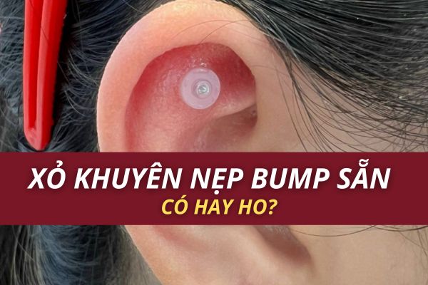 Xỏ khuyên nẹp bump luôn được không?