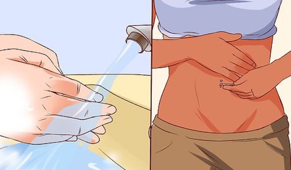 Cách chữa xỏ khuyên rốn bị lồi thịt hiệu quả và đơn giản tại nhà