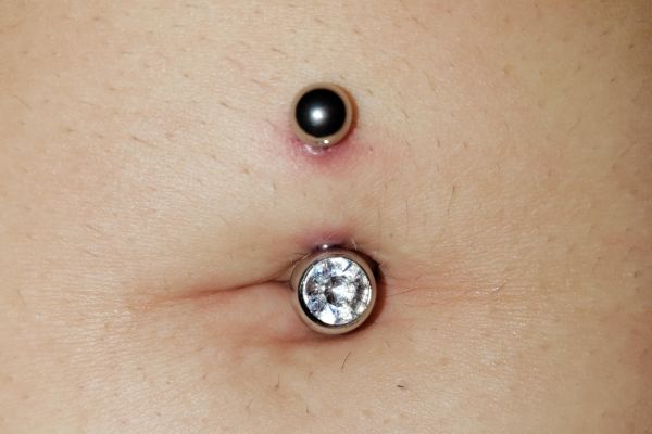 Xỏ khuyên rốn bị ngứa: Nguyên nhân & biện pháp xử lí