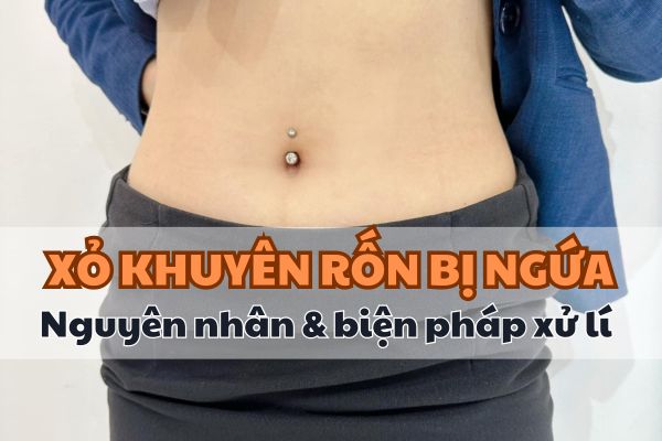 Xỏ khuyên rốn bị ngứa: Nguyên nhân & biện pháp xử lí