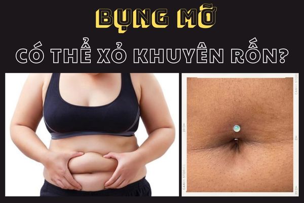 Xỏ khuyên rốn cho bụng mỡ, tại sao không?