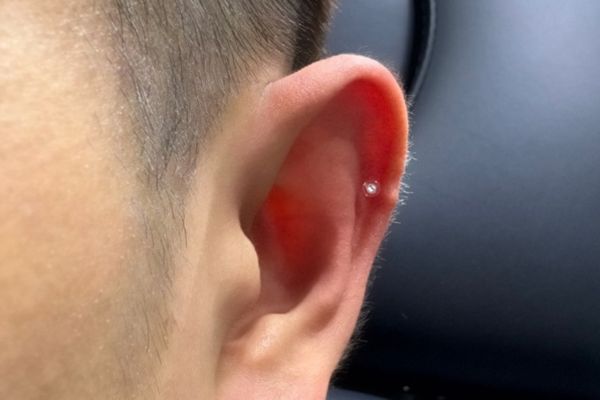 ảnh xỏ khuyên sụn tai