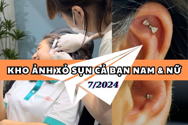 ảnh xỏ khuyên sụn tai