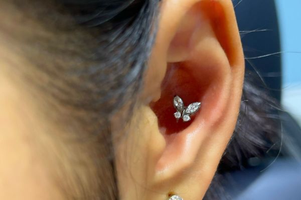 ảnh xỏ khuyên sụn tai