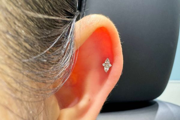 ảnh xỏ khuyên sụn tai