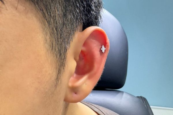 ảnh xỏ khuyên sụn tai