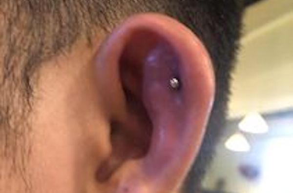xỏ khuyên tai bị viêm sụn