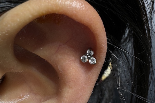 xỏ khuyên tai bị viêm sụn