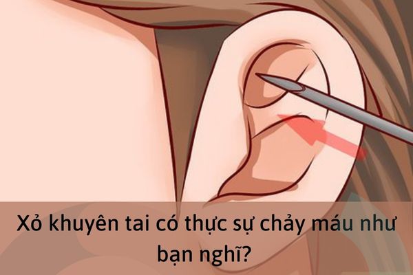 Xỏ khuyên tai có chảy máu không?