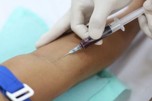 Xỏ khuyên tai có đau hơn xét nghiệm máu không?