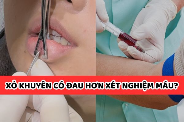 Xỏ khuyên tai có đau hơn xét nghiệm máu không?