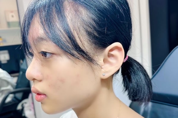 Hình ảnh xỏ khuyên tai em bé 2/2023 - Shop TinyBox