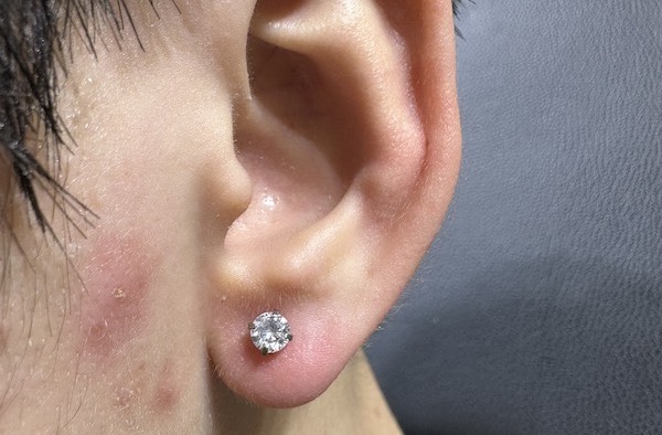 xỏ khuyên tai nam vị trí Lobe cá tính