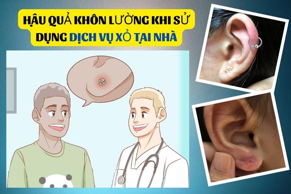 Dịch vụ xỏ khuyên tại nhà - Hậu quả khôn lường mà bạn nên biết