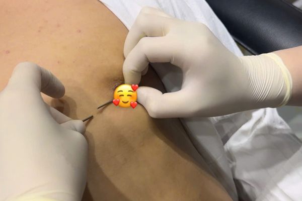 Xỏ khuyên ti nữ có đau không? Xỏ ti ở đâu uy tín TPHCM?