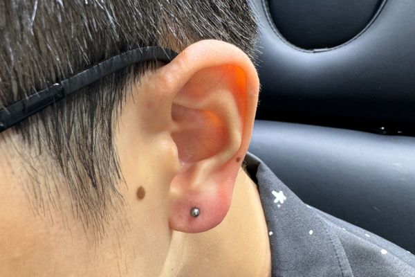 Xỏ lobe 1 tháng lành chưa?