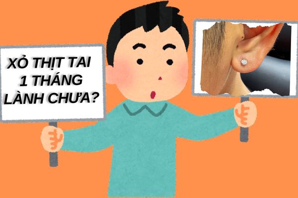 Xỏ lobe 1 tháng lành chưa?
