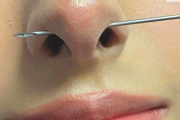 Xỏ Septum bị bump không?