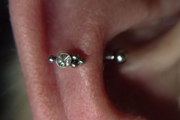 Xỏ Snug có đau không?