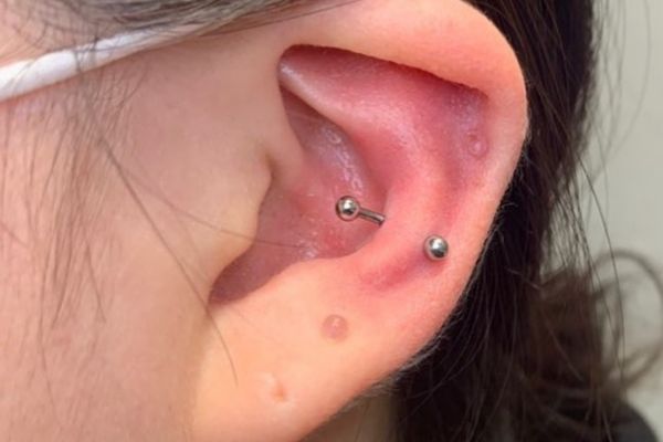 Xỏ Snug có đau không?